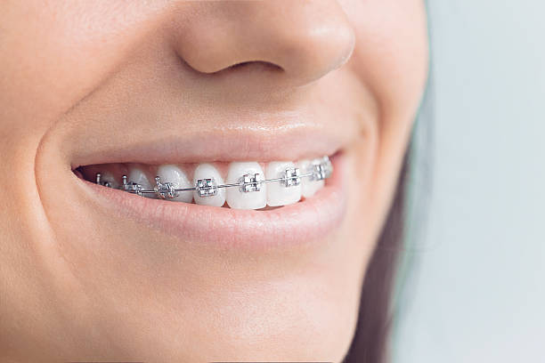 Why Choose Us for Your Dental Needs in Shenandoah, VA